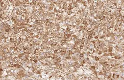 Anti-Apelin Receptor antibody [HL2980] used in IHC (Paraffin sections) (IHC-P). GTX640367