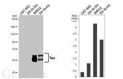 Anti-Tau antibody [HL2982] used in Western Blot (WB). GTX640369
