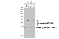 Anti-PAF Receptor antibody [HL2998] used in Western Blot (WB). GTX640408