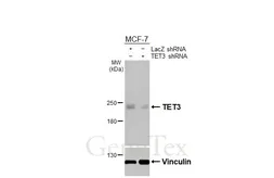 Anti-TET3 antibody [HL3009] used in Western Blot (WB). GTX640422