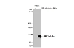 Anti-HIF1 alpha antibody [HL3011] used in Western Blot (WB). GTX640424