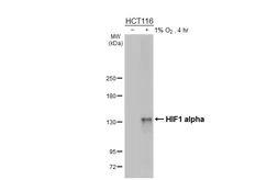 Anti-HIF1 alpha antibody [HL3011] used in Western Blot (WB). GTX640424
