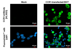Anti-CCR1 antibody [HL3023] used in Immunocytochemistry/ Immunofluorescence (ICC/IF). GTX640436