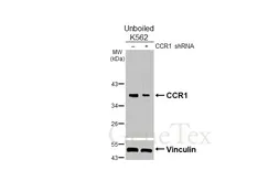 Anti-CCR1 antibody [HL3034] used in Western Blot (WB). GTX640472