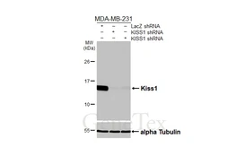 Anti-Kiss1 antibody [HL3043] used in Western Blot (WB). GTX640486