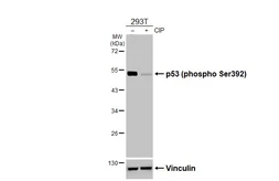 Anti-p53 (phospho Ser392) antibody [HL3047] used in Western Blot (WB). GTX640490