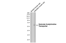 Anti-Vesicular Acetylcholine Transporter antibody [HL3053] used in Western Blot (WB). GTX640496