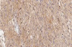 Anti-Smoothened homolog antibody [HL3055] used in IHC (Paraffin sections) (IHC-P). GTX640498