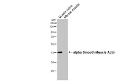 Anti-alpha Smooth Muscle Actin antibody [HL3088] used in Western Blot (WB). GTX640534