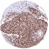 Anti-53BP1 antibody [HMV324] HistoMAX&trade; used in IHC (Paraffin sections) (IHC-P). GTX640556