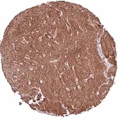 Anti-COL4A1 antibody [HMV327] HistoMAX&trade; used in IHC (Paraffin sections) (IHC-P). GTX640559
