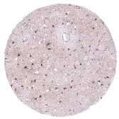 Anti-PSAT1 antibody [HMV331] HistoMAX&trade; used in IHC (Paraffin sections) (IHC-P). GTX640563