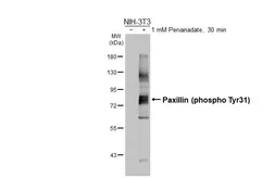 Anti-Paxillin (phospho Tyr31) antibody [HL3129] used in Western Blot (WB). GTX640615