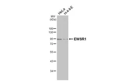 Anti-EWSR1 antibody [HL3150] used in Western Blot (WB). GTX640660