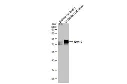 Anti-Kv1.2 antibody [HL3163] used in Western Blot (WB). GTX640673
