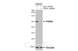 Anti-FOXA1 antibody [HL3168] used in Western Blot (WB). GTX640686