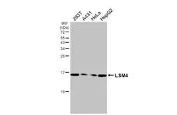 Anti-LSM4 antibody [HL3172] used in Western Blot (WB). GTX640690
