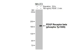 Anti-PDGF Receptor beta (phospho Tyr1009) antibody [HL3174] used in Western Blot (WB). GTX640692