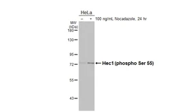 Anti-Hec1 (phospho Ser 55) antibody [HL3190] used in Western Blot (WB). GTX640829