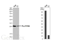 Anti-FLJ11184 antibody [HL3197] used in Western Blot (WB). GTX640837