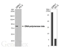 Anti-DNA polymerase iota antibody [HL3209] used in Western Blot (WB). GTX640849