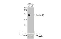 Anti-Lamin B1 antibody [HL3224] used in Western Blot (WB). GTX640865