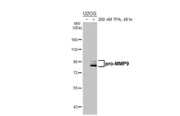 Anti-MMP9 antibody [HL3239] used in Western Blot (WB). GTX640882