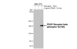 Anti-PDGF Receptor beta (phospho Tyr740) antibody [HL3244] used in Western Blot (WB). GTX640887