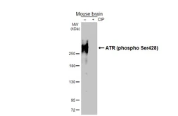 Anti-ATR (phospho Ser428) antibody [HL3246] used in Western Blot (WB). GTX640889