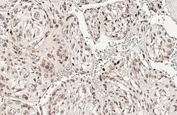 Anti-p63 antibody [HL3252] used in IHC (Paraffin sections) (IHC-P). GTX640899