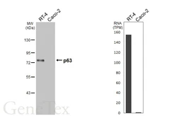 Anti-p63 antibody [HL3252] used in Western Blot (WB). GTX640899