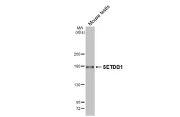 Anti-SETDB1 antibody [HL3259] used in Western Blot (WB). GTX640906