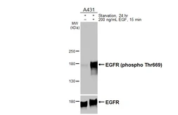 Anti-EGFR (phospho Thr669) antibody [HL3264] used in Western Blot (WB). GTX640911