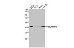 Anti-NDUFS2 antibody [HL3269] used in Western Blot (WB). GTX640923