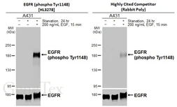 Anti-EGFR (phospho Tyr1148) antibody [HL3278] used in Western Blot (WB). GTX640932