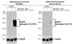Anti-EGFR (phospho Tyr1173) antibody [HL3280] used in Western Blot (WB). GTX640934