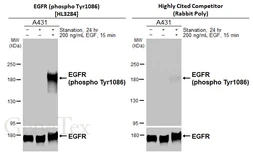 Anti-EGFR (phospho Tyr1086) antibody [HL3284] used in Western Blot (WB). GTX640938
