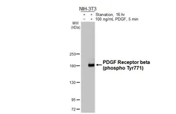 Anti-PDGF Receptor beta (phospho Tyr771) antibody [HL3300] used in Western Blot (WB). GTX640989