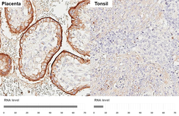 Anti-EGFR antibody [HL3325] used in IHC (Paraffin sections) (IHC-P). GTX641090