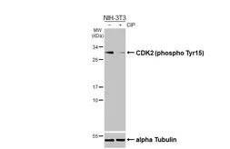 Anti-CDK2 (phospho Tyr15) antibody [HL3327] used in Western Blot (WB). GTX641092