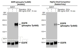 Anti-EGFR (phospho Tyr845) antibody [HL3331] used in Western Blot (WB). GTX641096