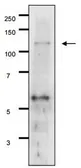 Anti-Gal 11 (S. cerevisiae) antibody used in Western Blot (WB). GTX64110