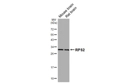 Anti-RPS2 antibody [HL3338] used in Western Blot (WB). GTX641110