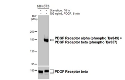 Anti-PDGF Receptor alpha (phospho Tyr849) + PDGF Receptor beta (phospho Tyr857) antibody [HL3345] used in Western Blot (WB). GTX641117