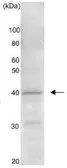 Anti-Gtr2 (S. cerevisiae) antibody used in Western Blot (WB). GTX64112