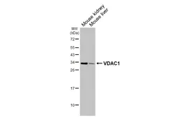 Anti-VDAC1 antibody [HL3373] used in Western Blot (WB). GTX641193