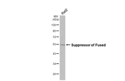 Anti-Suppressor of Fused antibody [HL3374] used in Western Blot (WB). GTX641194