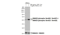Anti-SMAD2 (phospho Ser465 / Ser467)  +  SMAD3 (phospho Ser423 / Ser425) antibody [HL3379] used in Western Blot (WB). GTX641199