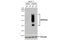 Anti-GPRC5A antibody [HL3393] used in Western Blot (WB). GTX641213
