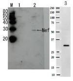 Anti-HIV1 Nef antibody used in Western Blot (WB). GTX64123